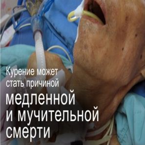 Kazakhstan 2013 Health Effect death - slow and painful death, lived experience